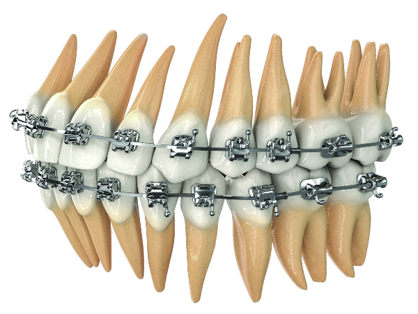 CCO SYSTEM bracket model