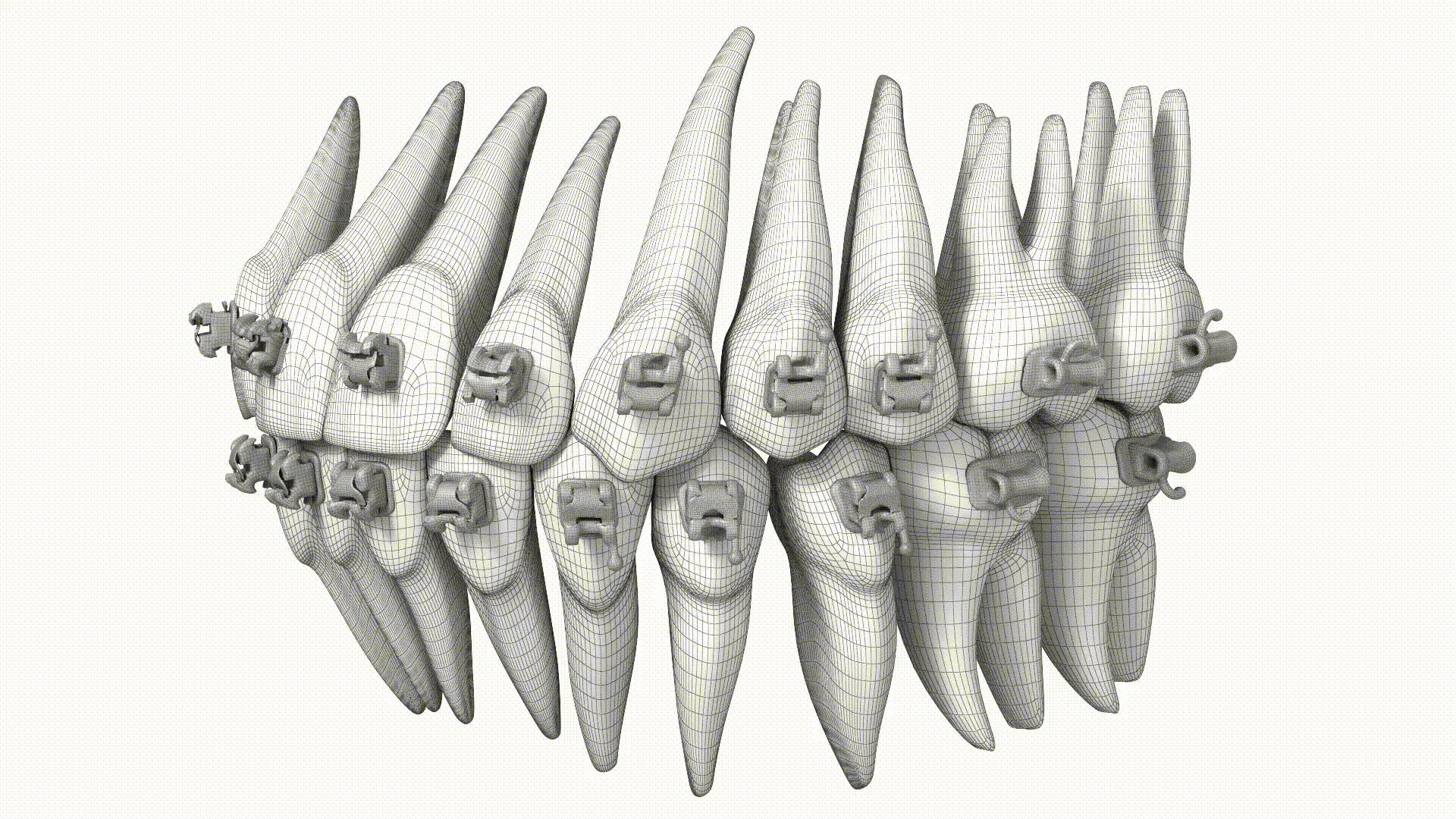 Super-Elastic Archwires
